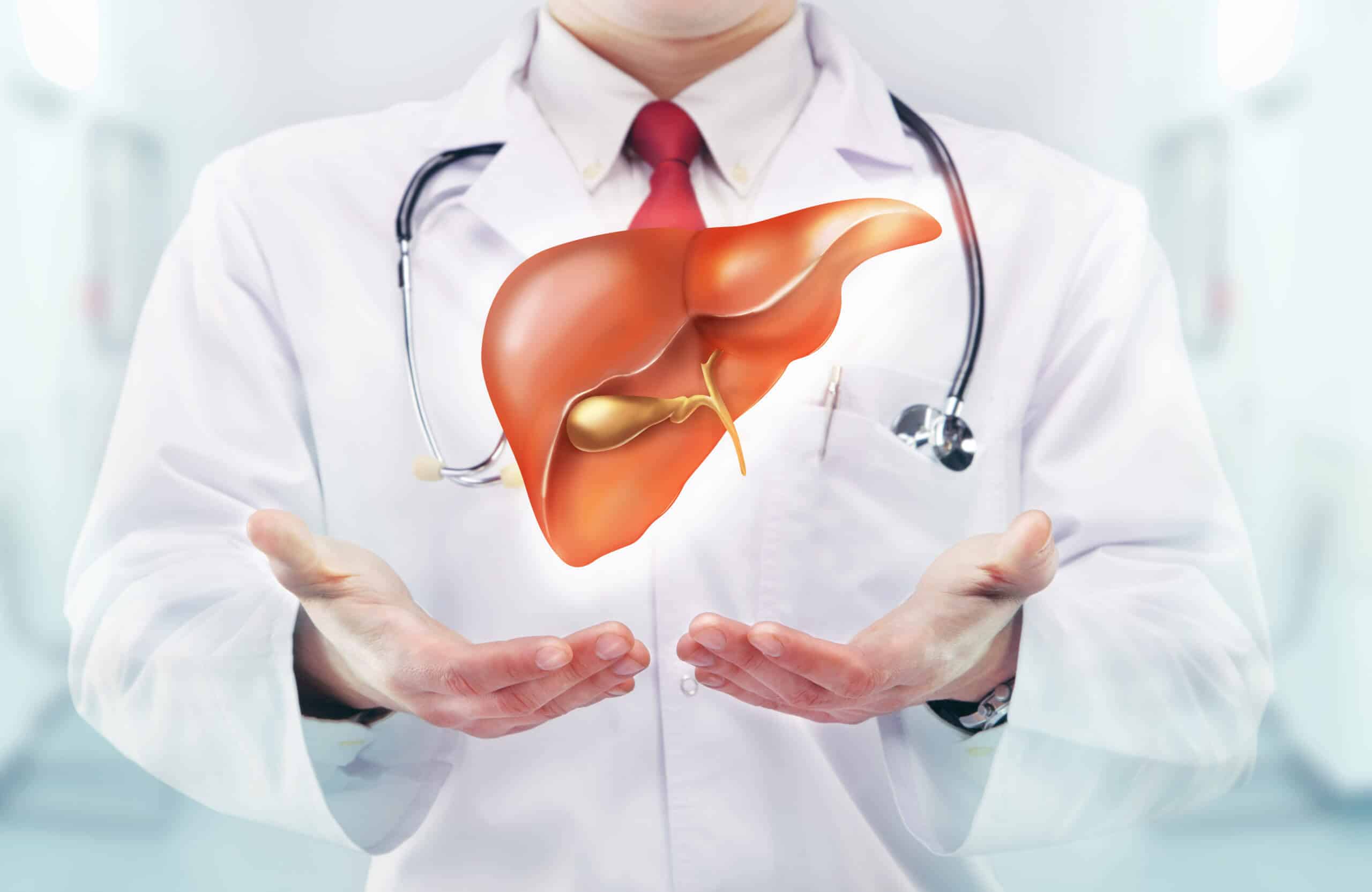 7 Cara Mengatasi Perlemakan Hati Paling Ampuh demi Menangkal Bahaya Sirosis Kronis memperlihatkan cara mengatasi perlemakan hati